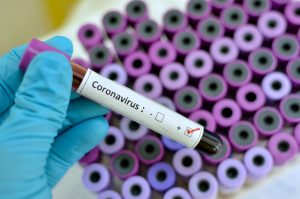 Coronavirus Pode Atrasar Pedidos De Carro PCD